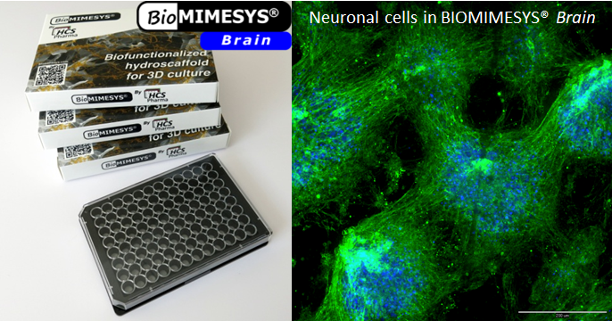 biotech info uncategorized bmms brain forumlabo grande 